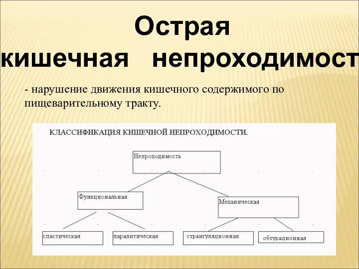 Острая кишечная непроходимость - нарушение движения кишечного содержимого по пищеварительному тракту.