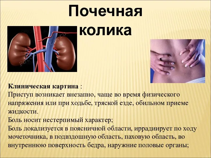 Почечная колика . Клиническая картина : Приступ возникает внезапно, чаще во время