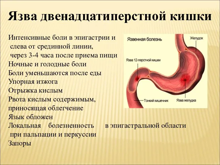 Язва двенадцатиперстной кишки Интенсивные боли в эпигастрии и слева от срединной линии,