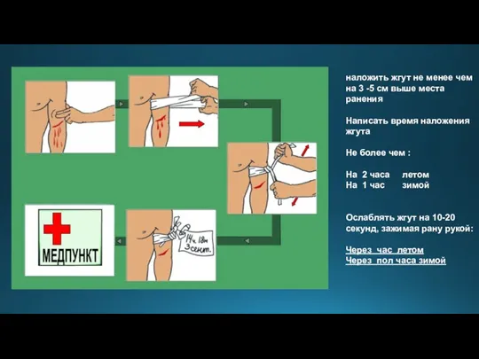 наложить жгут не менее чем на 3 -5 см выше места ранения