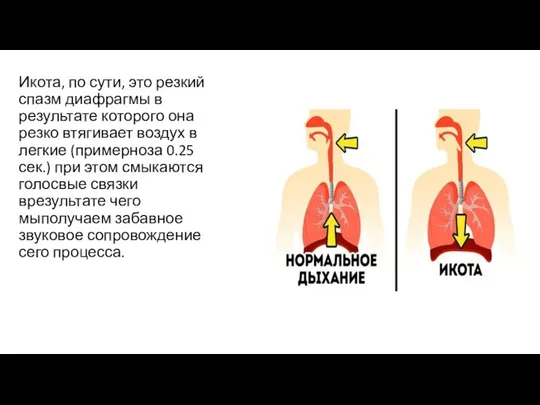 Икота, по сути, это резкий спазм диафрагмы в результате которого она резко