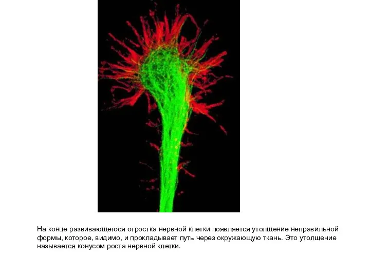 На конце развивающегося отростка нервной клетки появляется утолщение неправильной формы, которое, видимо,