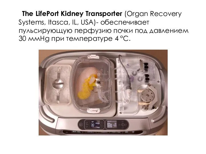 The LifePort Kidney Transporter (Organ Recovery Systems, Itasca, IL, USA)- обеспечивает пульсирующую