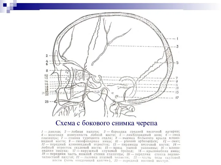 Схема с бокового снимка черепа
