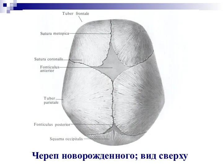 Череп новорожденного; вид сверху