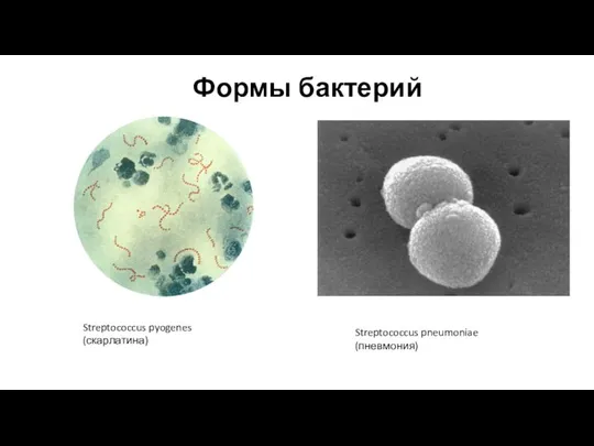 Формы бактерий Streptococcus pneumoniae (пневмония) Streptococcus pyogenes (скарлатина)