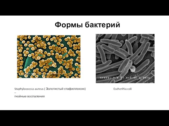 Формы бактерий Escherihia coli Staphylococcus aureus ( Золотистый стафиллококк) – гнойные воспаления