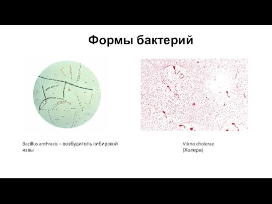 Формы бактерий Vibrio cholerae (Холера) Bacillus anthracis – возбудитель сибирской язвы