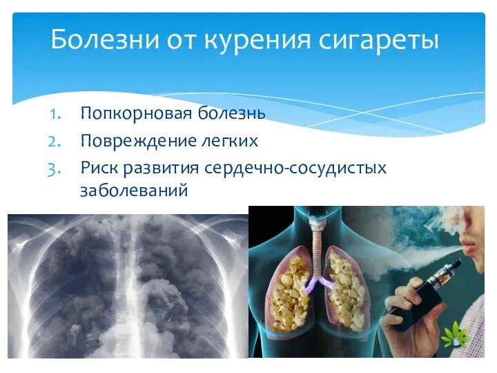 Попкорновая болезнь Повреждение легких Риск развития сердечно-сосудистых заболеваний Болезни от курения сигареты
