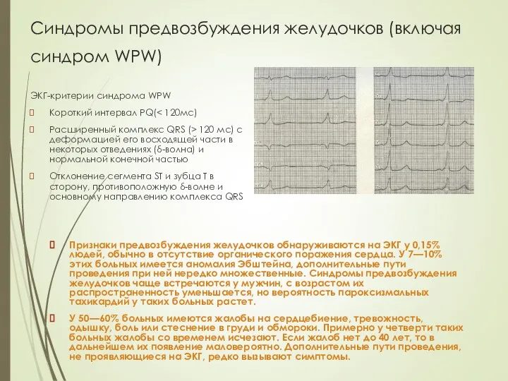 Синдромы предвозбуждения желудочков (включая синдром WPW) ЭКГ-критерии синдрома WPW Короткий интервал PQ(