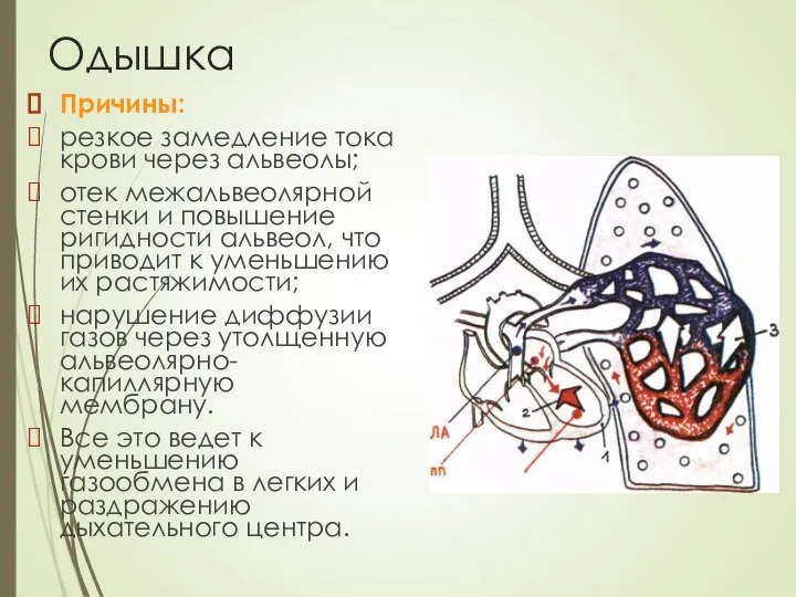 Одышка Причины: резкое замедление тока крови через альвеолы; отек межальвеолярной стенки и