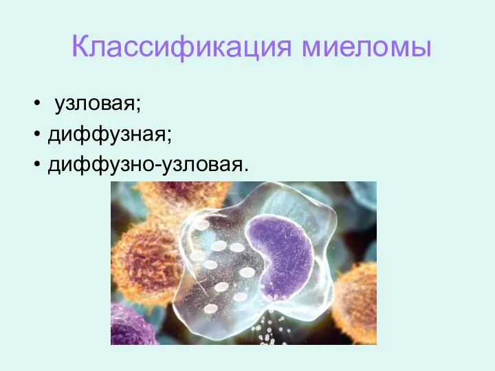 узловая; диффузная; диффузно-узловая. Классификация миеломы