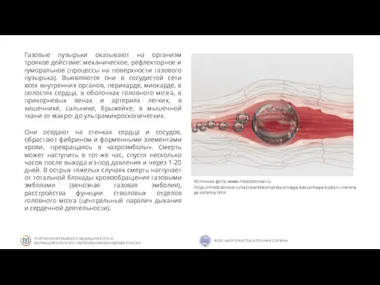 Газовые пузырьки оказывают на организм троякое действие: механическое, рефлекторное и гуморальное (процессы