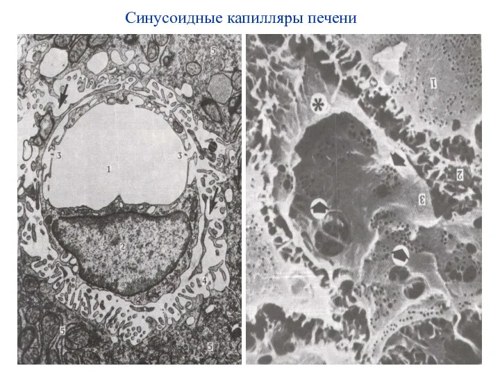 Синусоидные капилляры печени