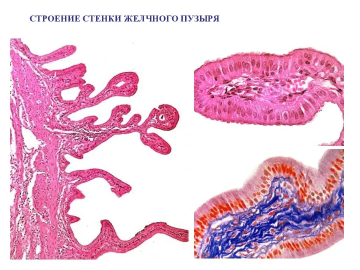 СТРОЕНИЕ СТЕНКИ ЖЕЛЧНОГО ПУЗЫРЯ