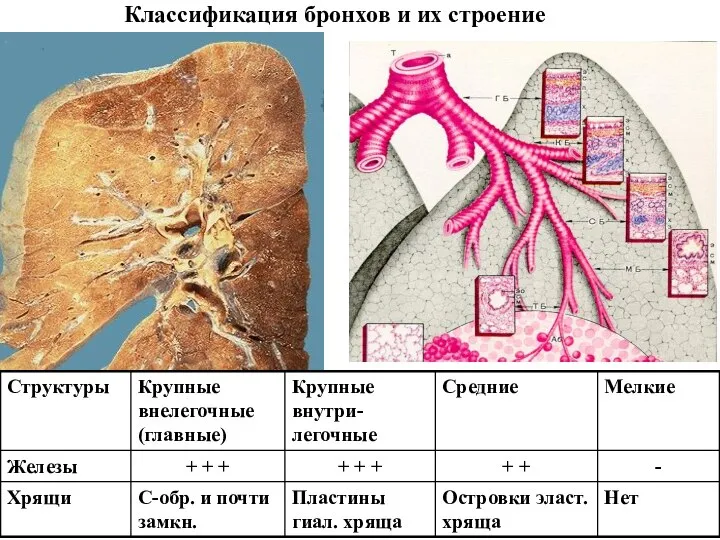 Классификация бронхов и их строение