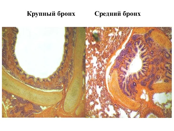 Крупный бронх Средний бронх