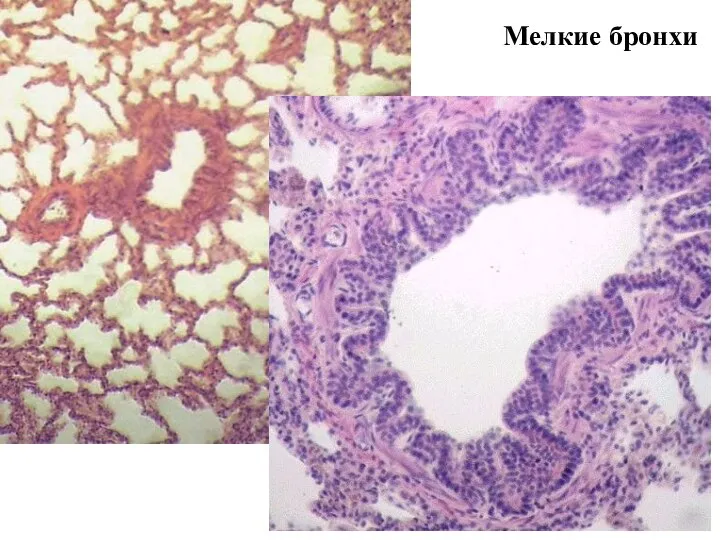 Мелкие бронхи