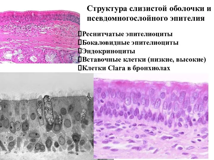 Структура слизистой оболочки и псевдомногослойного эпителия Реснитчатые эпителиоциты Бокаловидные эпителиоциты Эндокриноциты Вставочные