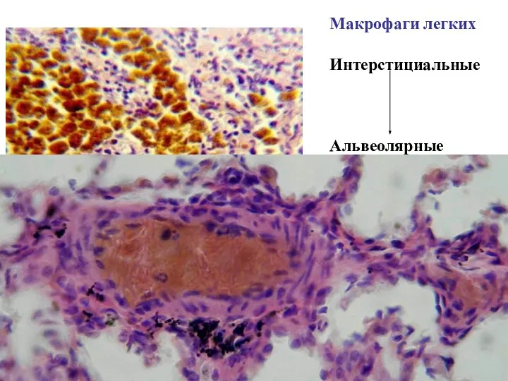 Макрофаги легких Интерстициальные Альвеолярные