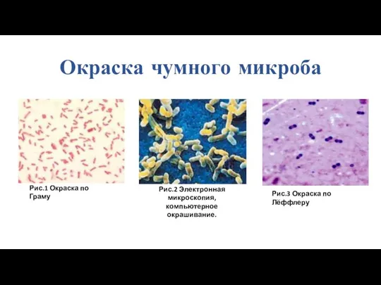 Окраска чумного микроба Рис.3 Окраска по Лёффлеру