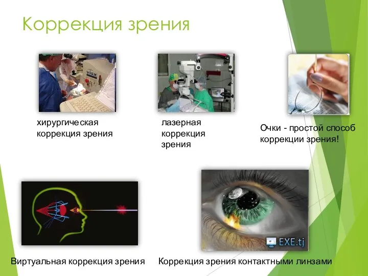 Коррекция зрения хирургическая коррекция зрения Виртуальная коррекция зрения лазерная коррекция зрения Коррекция