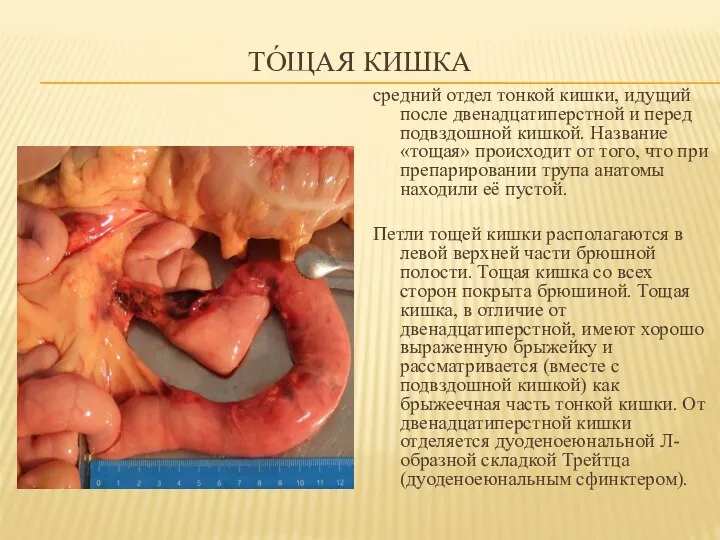 ТО́ЩАЯ КИШКА средний отдел тонкой кишки, идущий после двенадцатиперстной и перед подвздошной