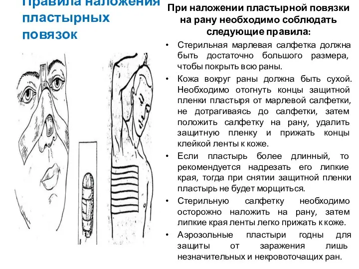 Правила наложения пластырных повязок При наложении пластырной повязки на рану необходимо соблюдать