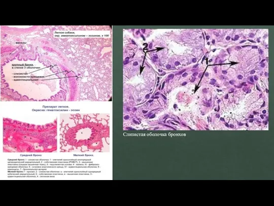 Слизистая оболочка бронхов