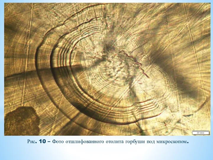 Рис. 10 – Фото отшлифованного отолита горбуши под микроскопом.