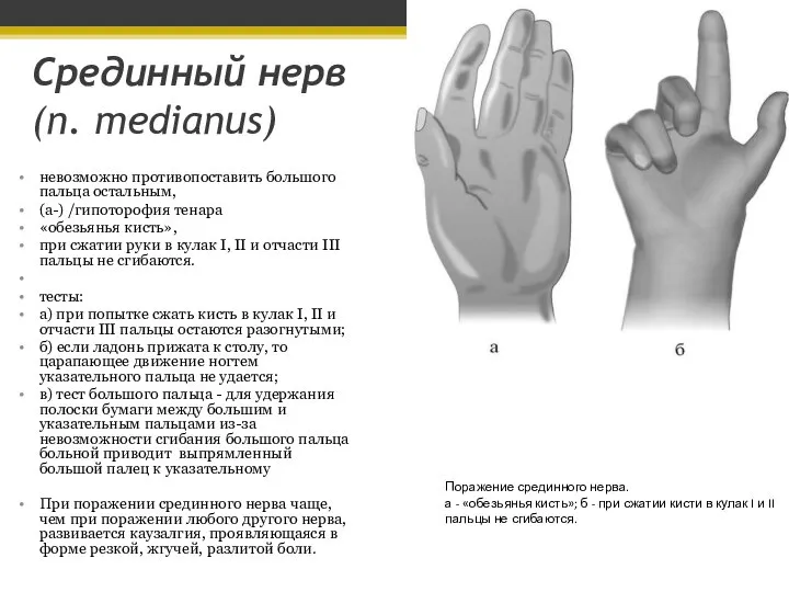 Срединный нерв (n. medianus) невозможно противопоставить большого пальца остальным, (а-) /гипоторофия тенара