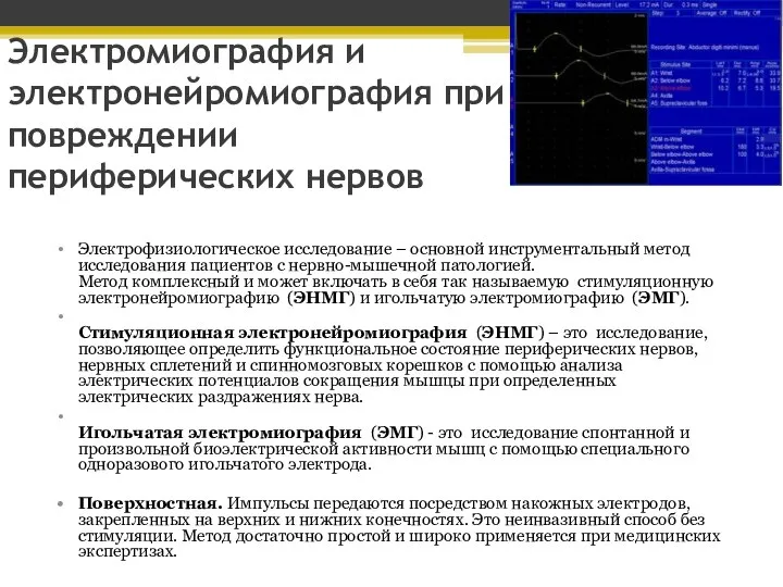 Электромиография и электронейромиография при повреждении периферических нервов Электрофизиологическое исследование – основной инструментальный