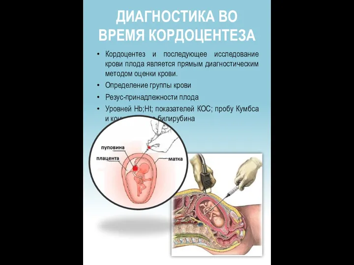 ДИАГНОСТИКА ВО ВРЕМЯ КОРДОЦЕНТЕЗА Кордоцентез и последующее исследование крови плода является прямым