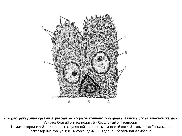 Ультраструктурная организация эпителиоцитов концевого отдела главной простатической железы А - столбчатый эпителиоцит;