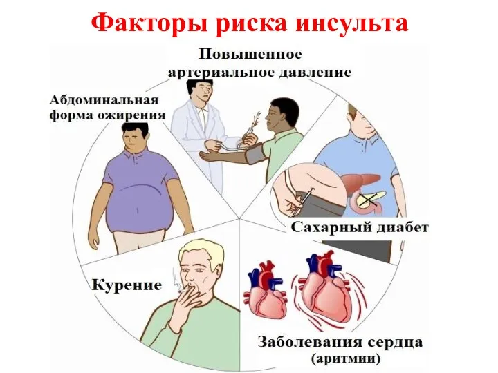 Факторы риска инсульта