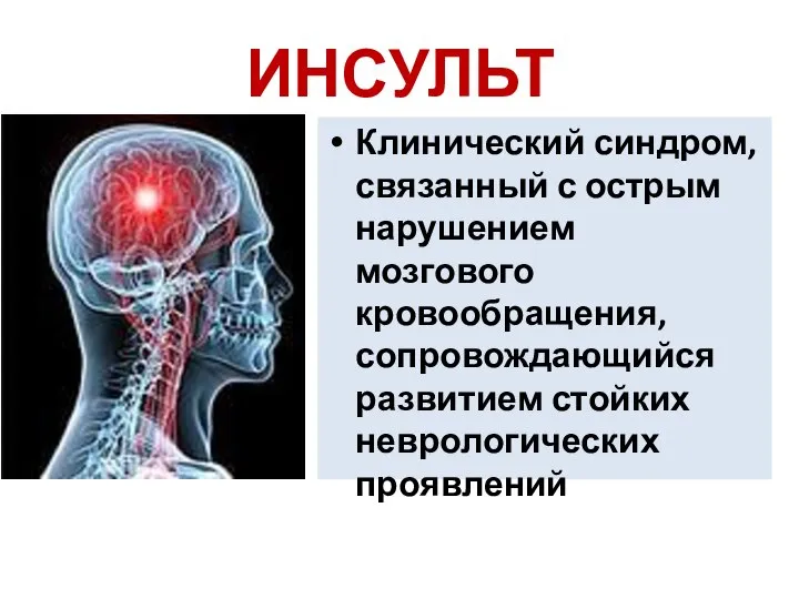 ИНСУЛЬТ Клинический синдром, связанный с острым нарушением мозгового кровообращения, сопровождающийся развитием стойких неврологических проявлений