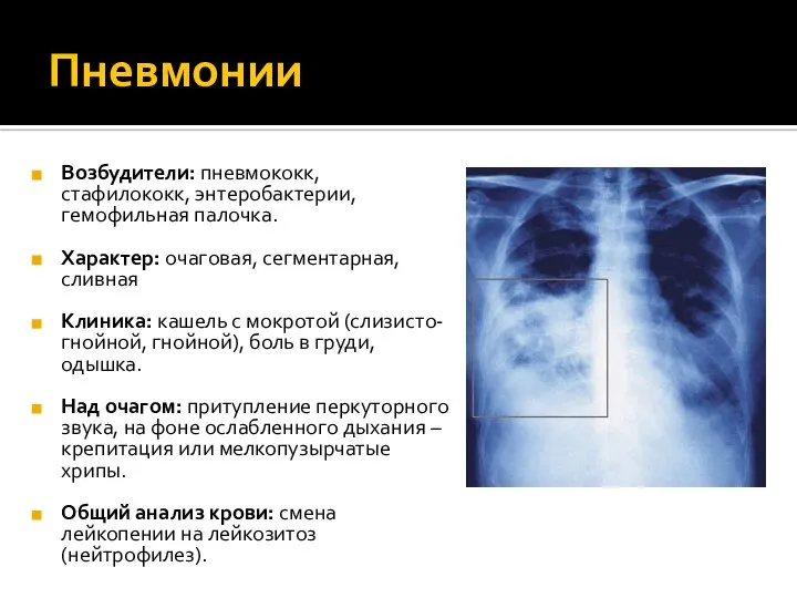 Пневмонии Возбудители: пневмококк, стафилококк, энтеробактерии, гемофильная палочка. Характер: очаговая, сегментарная, сливная Клиника: