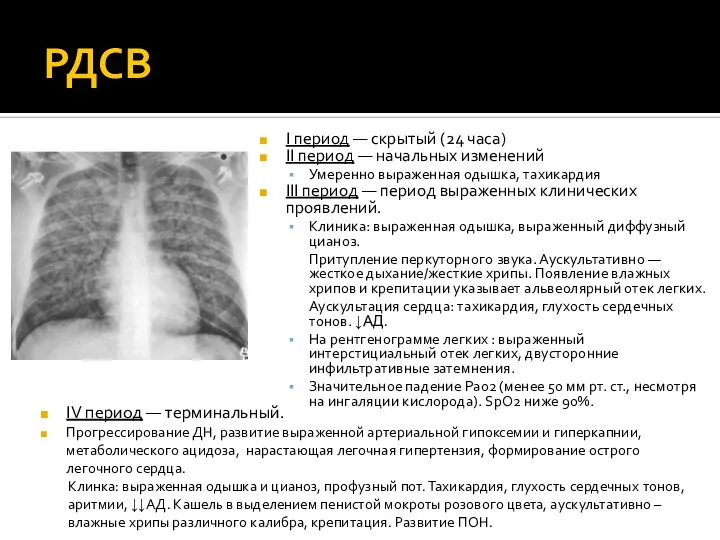 РДСВ I период — скрытый (24 часа) II период — начальных изменений