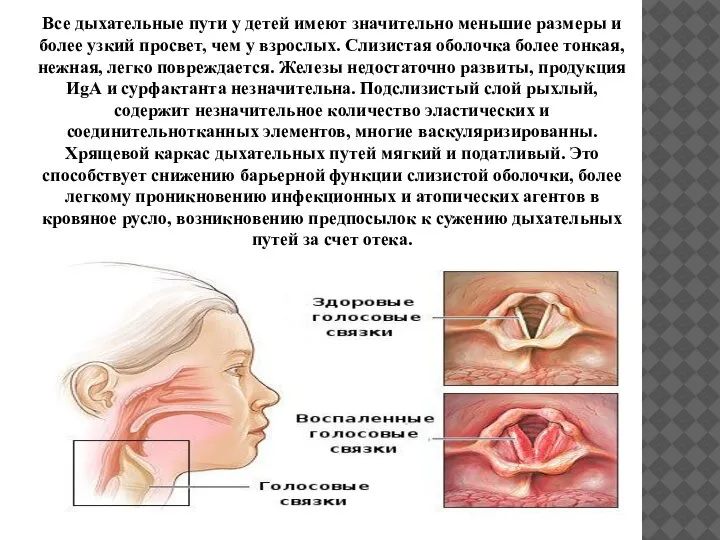 Все дыхательные пути у детей имеют значительно меньшие размеры и более узкий