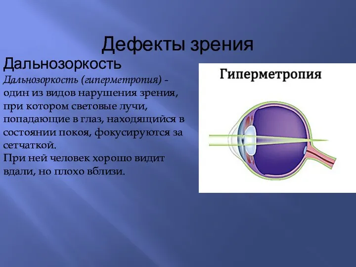 Дефекты зрения Дальнозоркость Дальнозоркость (гиперметропия) - один из видов нарушения зрения, при