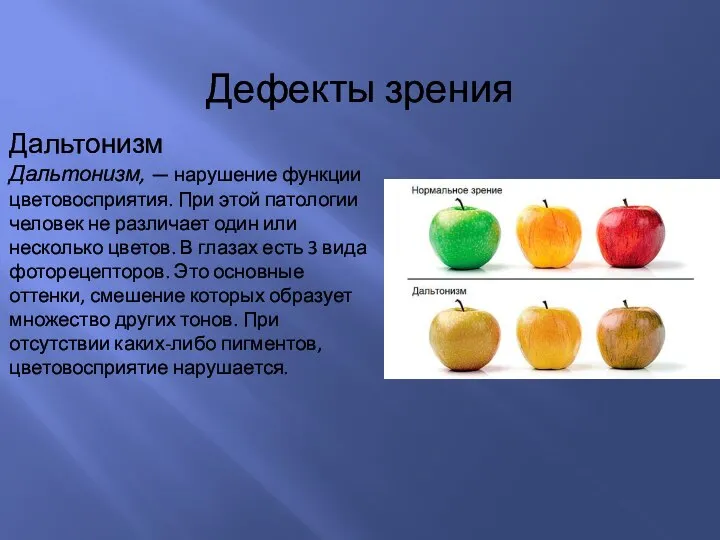 Дефекты зрения Дальтонизм Дальтонизм, — нарушение функции цветовосприятия. При этой патологии человек