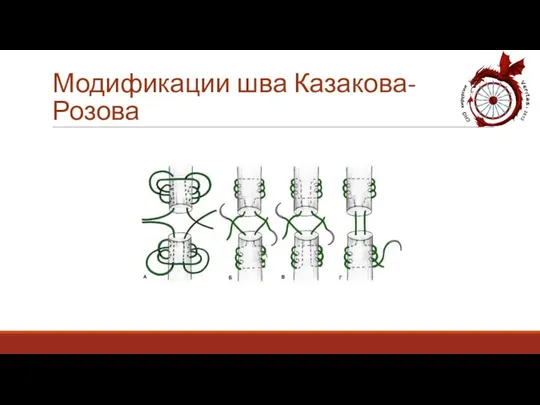 Модификации шва Казакова-Розова