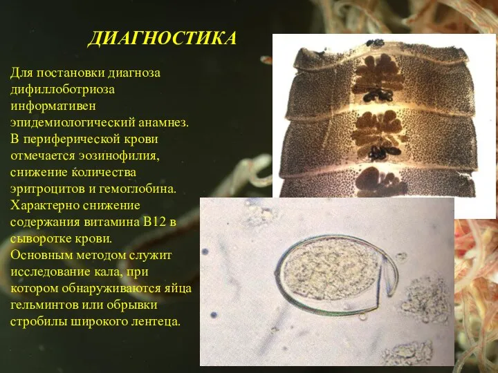 ДИАГНОСТИКА Для постановки диагноза дифиллоботриоза информативен эпидемиологический анамнез. В периферической крови отмечается