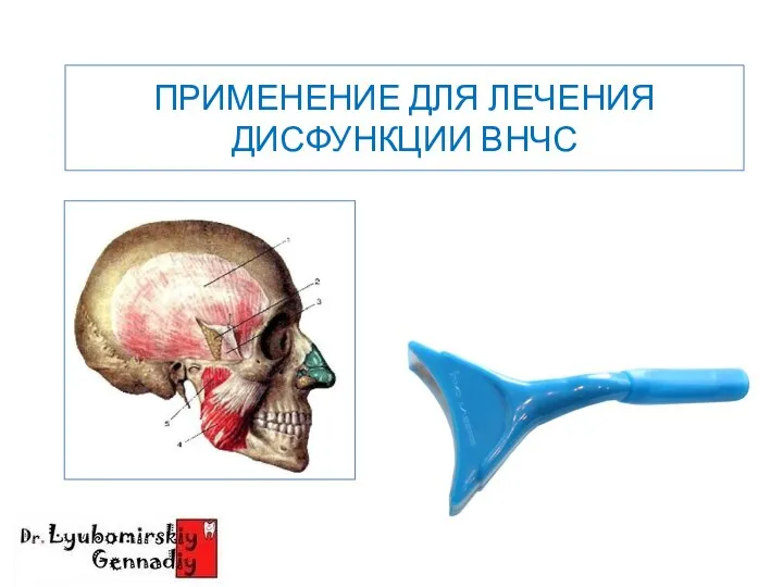 ПРИМЕНЕНИЕ ДЛЯ ЛЕЧЕНИЯ ДИСФУНКЦИИ ВНЧС