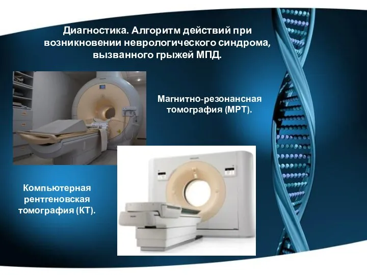 Диагностика. Алгоритм действий при возникновении неврологического синдрома, вызванного грыжей МПД. Магнитно-резонансная томография