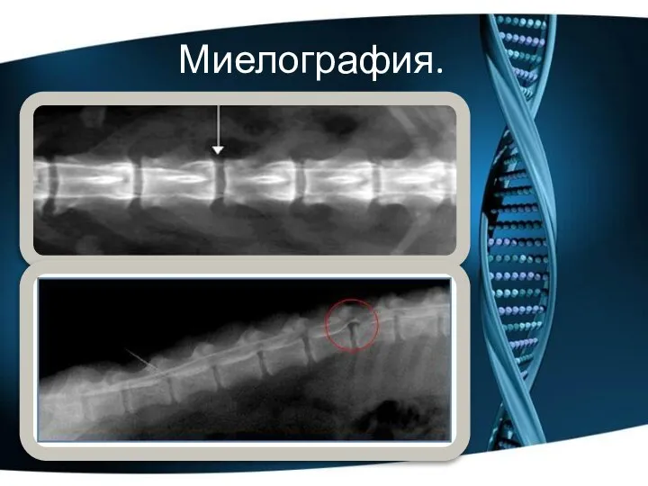 Миелография.