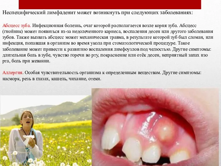 Неспецифический лимфаденит может возникнуть при следующих заболеваниях: Абсцесс зуба. Инфекционная болезнь, очаг