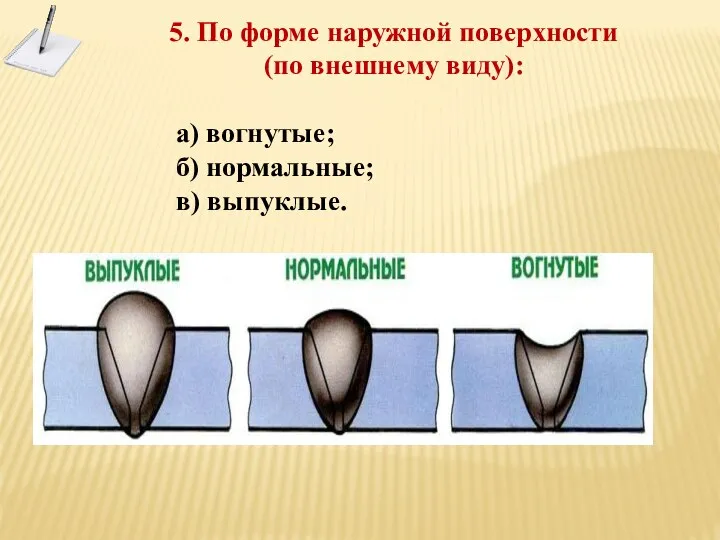 5. По форме наружной поверхности (по внешнему виду): а) вогнутые; б) нормальные; в) выпуклые.