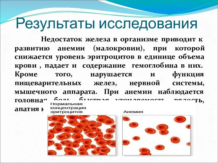 Результаты исследования Недостаток железа в организме приводит к развитию анемии (малокровии), при