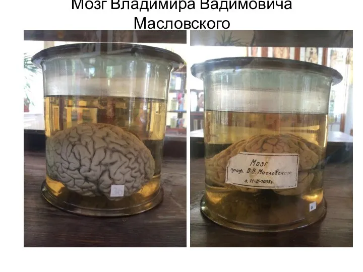 Мозг Владимира Вадимовича Масловского